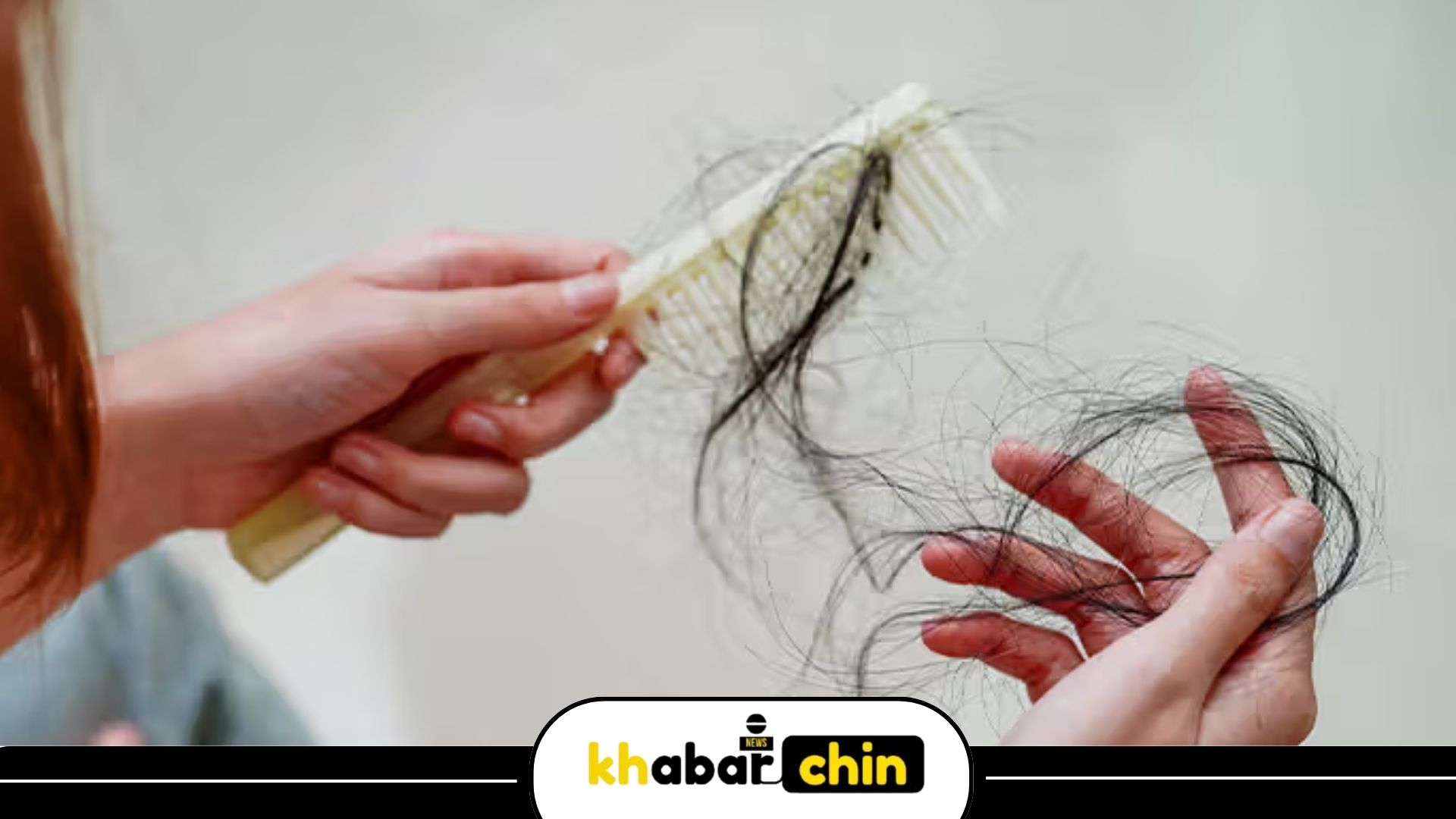 علت ریزش موی شدید در زنان ؛ از کمبود آهن تا اختلالات تیروئید